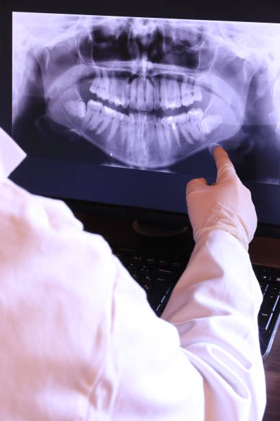 Best Emergency Treatment for Oral Infections in Mooreville, MS