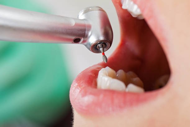 Best Lost Filling or Crown Replacement in Mooreville, MS